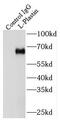 Plastin-2 antibody, FNab04832, FineTest, Immunoprecipitation image 