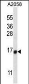 Testis Expressed 261 antibody, PA5-48542, Invitrogen Antibodies, Western Blot image 