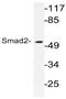 SMAD2 antibody, AP21095PU-N, Origene, Western Blot image 