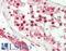 BNC1 antibody, LS-B13586, Lifespan Biosciences, Immunohistochemistry paraffin image 