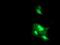 Dystrobrevin beta antibody, NBP2-01798, Novus Biologicals, Immunocytochemistry image 