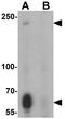 Testis And Ovary Specific PAZ Domain Containing 1 antibody, GTX32132, GeneTex, Western Blot image 