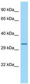 Ribosomal Protein S4 Y-Linked 2 antibody, TA334367, Origene, Western Blot image 