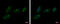 Ectonucleotide Pyrophosphatase/Phosphodiesterase 2 antibody, GTX106209, GeneTex, Immunocytochemistry image 