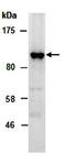 Fanconi anemia group I protein antibody, orb66889, Biorbyt, Western Blot image 