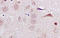 Midnolin antibody, 251273, Abbiotec, Immunohistochemistry paraffin image 