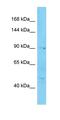 NOP14 Nucleolar Protein antibody, orb327335, Biorbyt, Western Blot image 