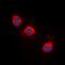 Neurotrophic Receptor Tyrosine Kinase 1 antibody, orb315639, Biorbyt, Immunofluorescence image 