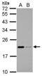 Apolipoprotein M antibody, GTX106750, GeneTex, Western Blot image 