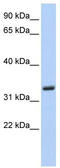 Membrane Spanning 4-Domains A4A antibody, TA344314, Origene, Western Blot image 