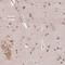 Putative uncharacterized protein ENSP00000383407 antibody, HPA046639, Atlas Antibodies, Immunohistochemistry frozen image 