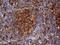 Clathrin Light Chain A antibody, LS-C798713, Lifespan Biosciences, Immunohistochemistry paraffin image 