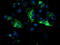 Dihydrolipoamide Dehydrogenase antibody, LS-C173245, Lifespan Biosciences, Immunofluorescence image 