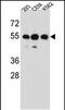 Zinc Finger Protein 562 antibody, PA5-48415, Invitrogen Antibodies, Western Blot image 