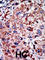 Phosphofructokinase, Liver Type antibody, abx033895, Abbexa, Western Blot image 