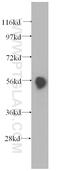 Pancreatic Lipase antibody, 11209-1-AP, Proteintech Group, Western Blot image 
