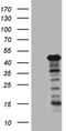 Lysine Methyltransferase 5A antibody, CF808173, Origene, Western Blot image 