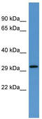 Calcium-binding protein 4 antibody, TA342743, Origene, Western Blot image 