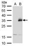 Neurogenin 1 antibody, GTX129224, GeneTex, Western Blot image 