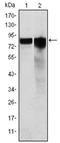 Glycogen Synthase 1 antibody, AM06571SU-N, Origene, Western Blot image 