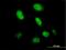 Highly divergent homeobox antibody, H00139324-B01P, Novus Biologicals, Immunofluorescence image 