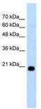 F-box only protein 25 antibody, TA329822, Origene, Western Blot image 