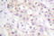 PKC antibody, LS-C176455, Lifespan Biosciences, Immunohistochemistry frozen image 
