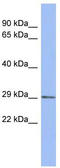 Polysaccharide Biosynthesis Domain Containing 1 antibody, TA345013, Origene, Western Blot image 