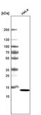 Cancer/Testis Antigen 83 antibody, MA5-24711, Invitrogen Antibodies, Western Blot image 