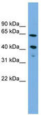ATPase Phospholipid Transporting 8B2 antibody, TA336163, Origene, Western Blot image 
