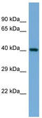 Interleukin enhancer-binding factor 2 antibody, TA329935, Origene, Western Blot image 