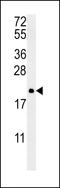 Protein Tyrosine Phosphatase 4A2 antibody, LS-C162296, Lifespan Biosciences, Western Blot image 