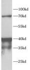 ADA1 antibody, FNab10435, FineTest, Western Blot image 