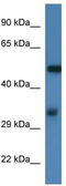 HSN antibody, TA339259, Origene, Western Blot image 