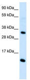 C-C motif chemokine 18 antibody, TA330388, Origene, Western Blot image 