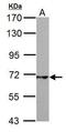 Phosphoenolpyruvate carboxykinase [GTP], mitochondrial antibody, GTX104663, GeneTex, Western Blot image 