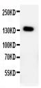Patched 2 antibody, PA1859, Boster Biological Technology, Western Blot image 