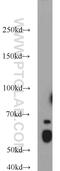 Kruppel Like Factor 4 antibody, 11880-1-AP, Proteintech Group, Western Blot image 