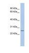 Chromosome 11 Open Reading Frame 53 antibody, NBP1-57594, Novus Biologicals, Western Blot image 