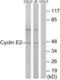 CCNE2 antibody, LS-C117868, Lifespan Biosciences, Western Blot image 