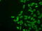 Serine/threonine-protein kinase PRKY antibody, M14965, Boster Biological Technology, Immunofluorescence image 