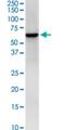 HCLS1 Binding Protein 3 antibody, H00064342-M01, Novus Biologicals, Western Blot image 