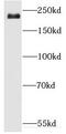 Dedicator of cytokinesis protein 3 antibody, FNab02494, FineTest, Western Blot image 