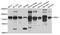 MKS Transition Zone Complex Subunit 1 antibody, A4802, ABclonal Technology, Western Blot image 