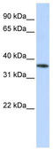 Olfactory Receptor Family 13 Subfamily C Member 5 antibody, TA329334, Origene, Western Blot image 