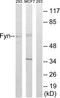 FYN Proto-Oncogene, Src Family Tyrosine Kinase antibody, TA326081, Origene, Western Blot image 