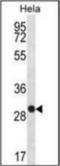 WAP four-disulfide core domain protein 1 antibody, orb258013, Biorbyt, Western Blot image 