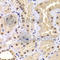 PR/SET Domain 14 antibody, A5543, ABclonal Technology, Immunohistochemistry paraffin image 