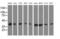 3-Hydroxyisobutyryl-CoA Hydrolase antibody, MA5-25155, Invitrogen Antibodies, Western Blot image 