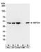 Methionine Adenosyltransferase 2A antibody, A304-279A, Bethyl Labs, Western Blot image 